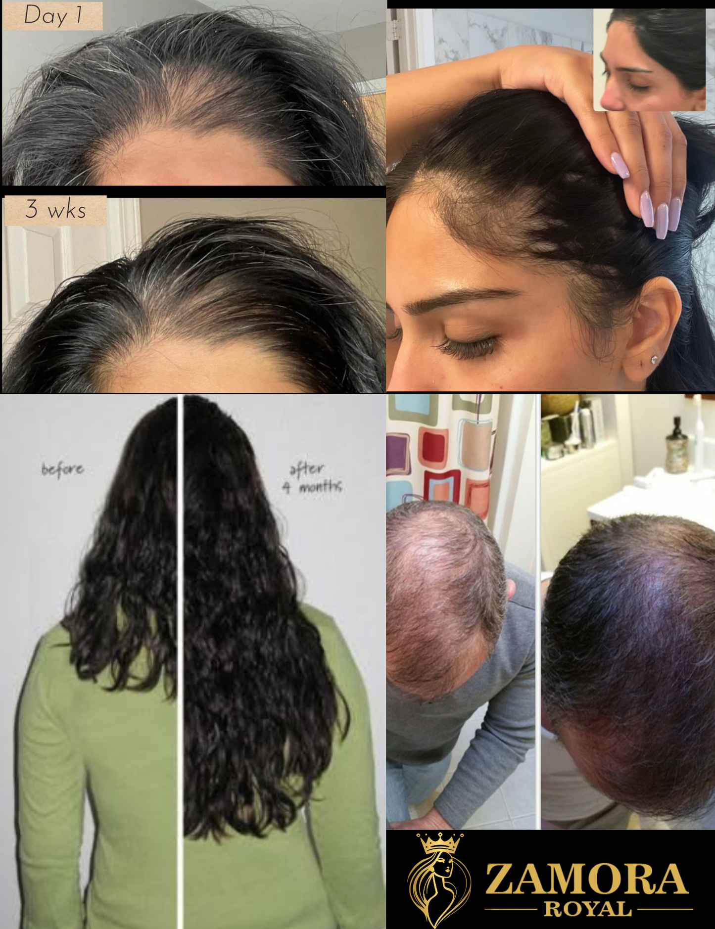 Zamora Royal Best Organic Hair Oil With Neem Wood Comb