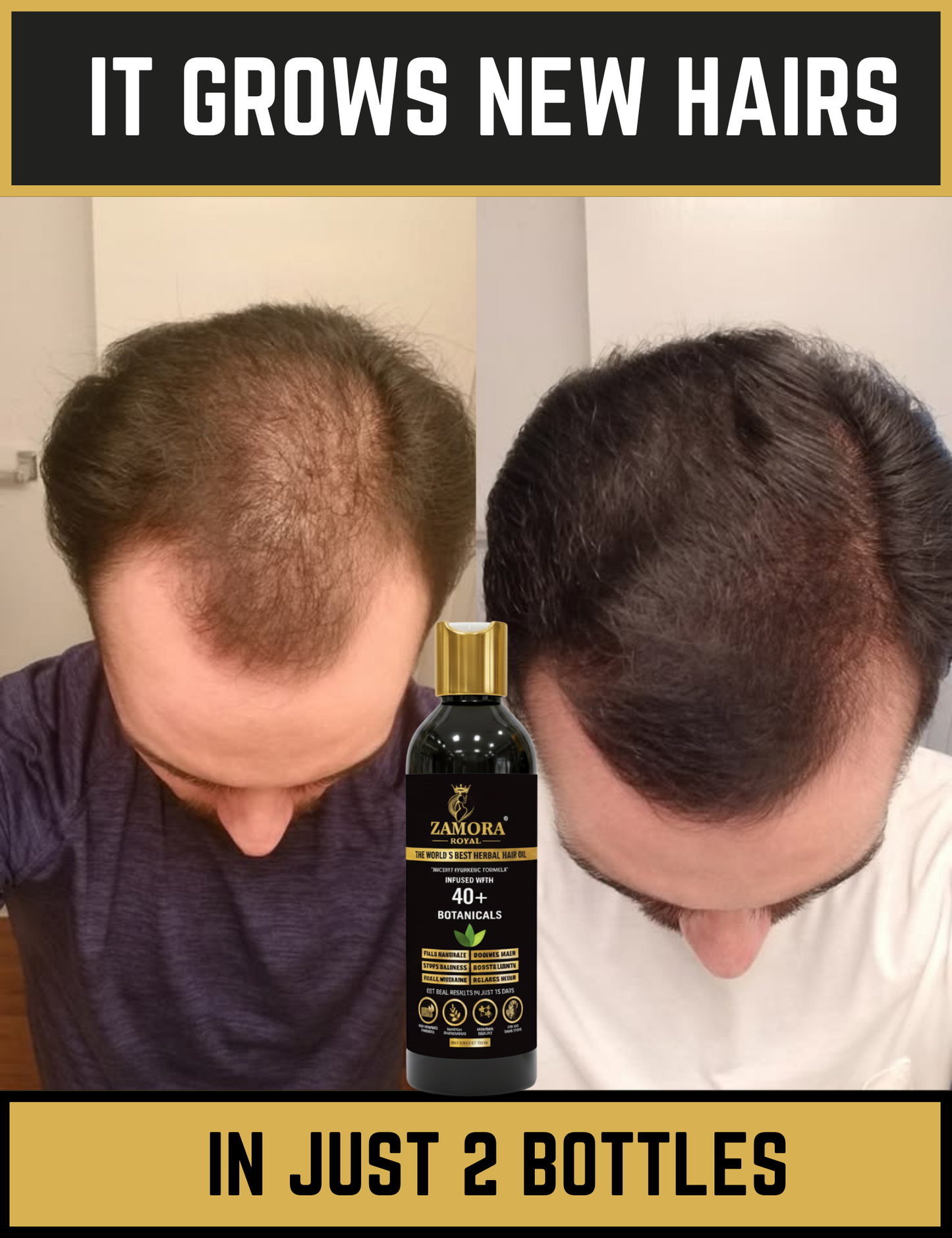 Zamora Royal Best Organic Hair Oil With Neem Wood Comb
